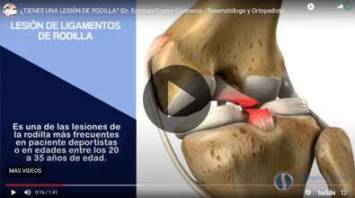 Knee surgery Dr. Esteban Castro Contreras - Traumatologist and Orthopedist
